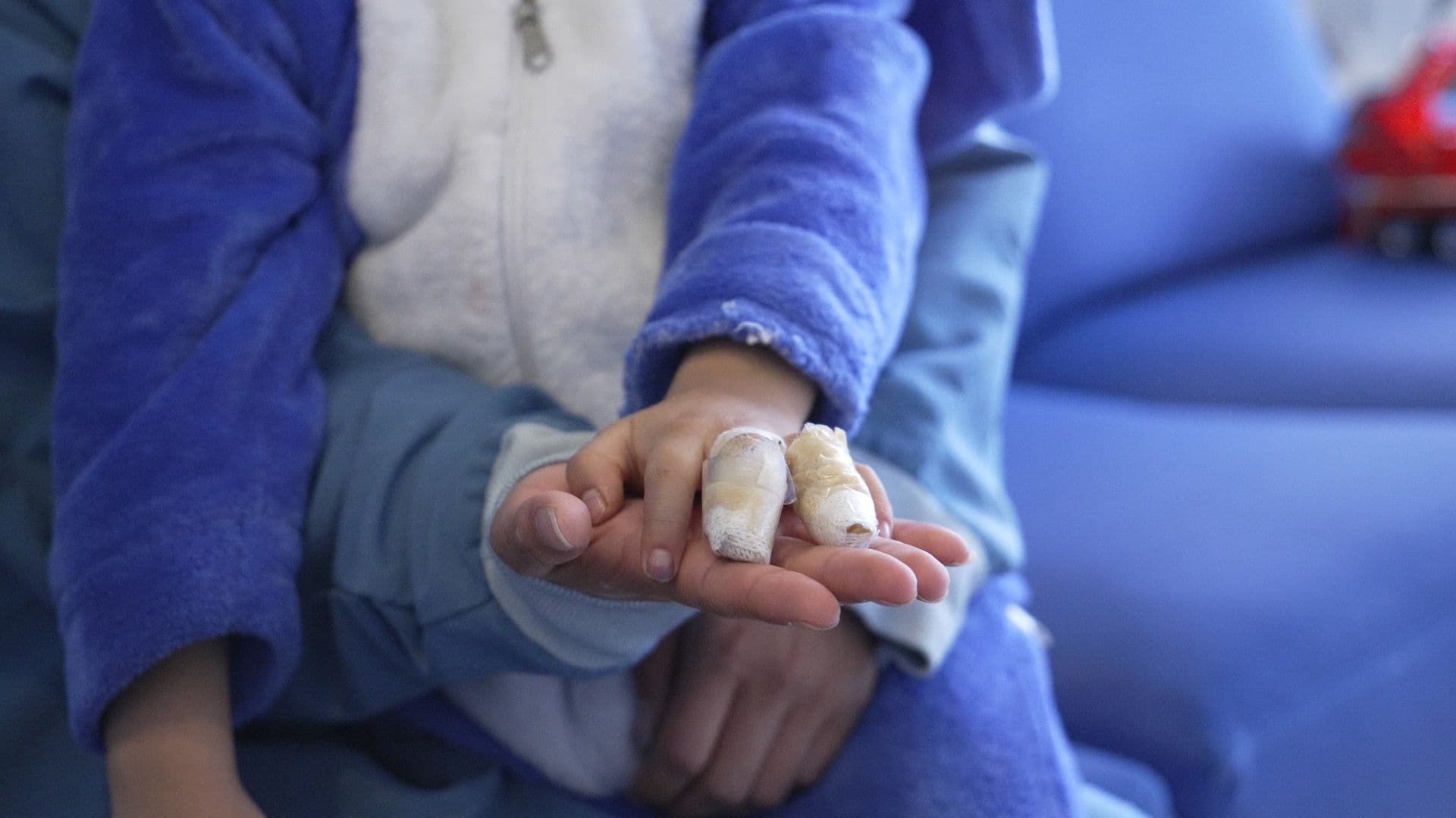 quemados pólvora Alcaldía de Bogotá quemados pólvora Alcaldía de Bogotá