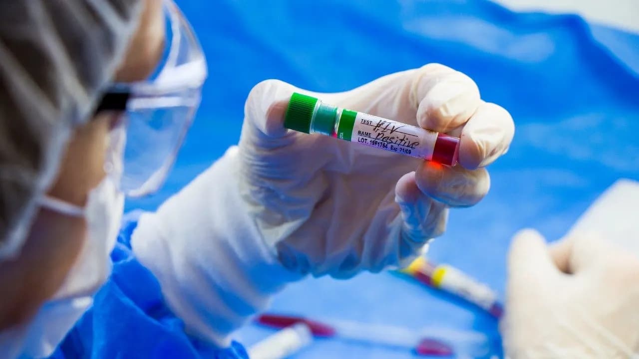 photologuephotos2025-04hiv-aids-infection-test-doctors-face-hand-holding-tube-with-blood-blue-background_1jpg photologuephotos2025-04hiv-aids-infection-test-doctors-face-hand-holding-tube-with-blood-blue-background_1jpg