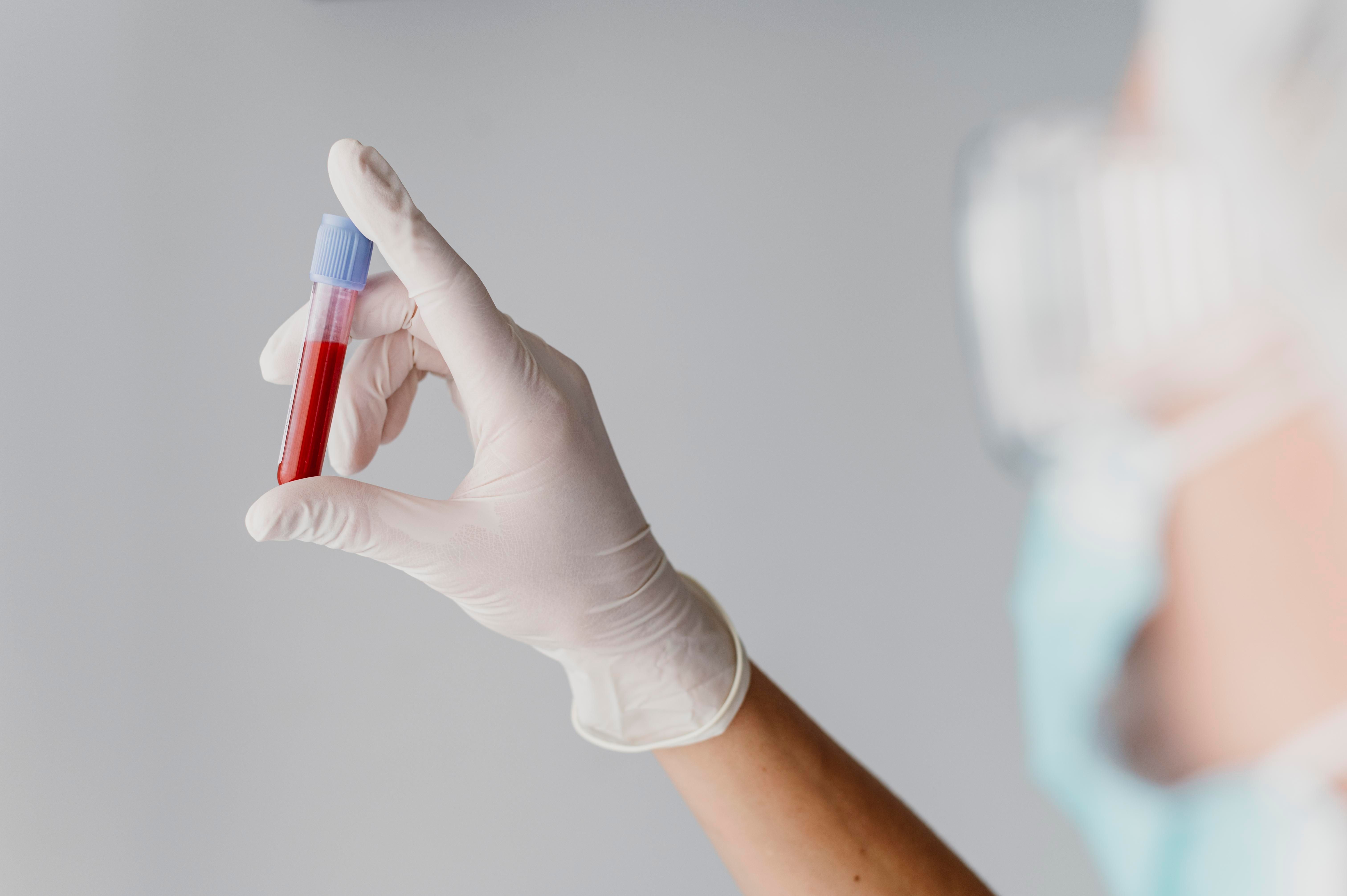 medico-vista-posterior-sosteniendo-muestra-sangre.jpg